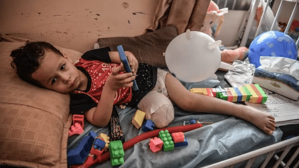 غزه؛ رکورددار بیشترین قطع عضو کودکان در جهان